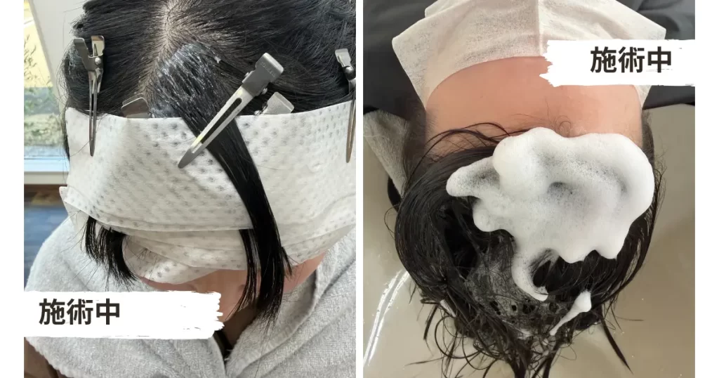 前髪のパックリ割れは「クロスパーマ」で解決